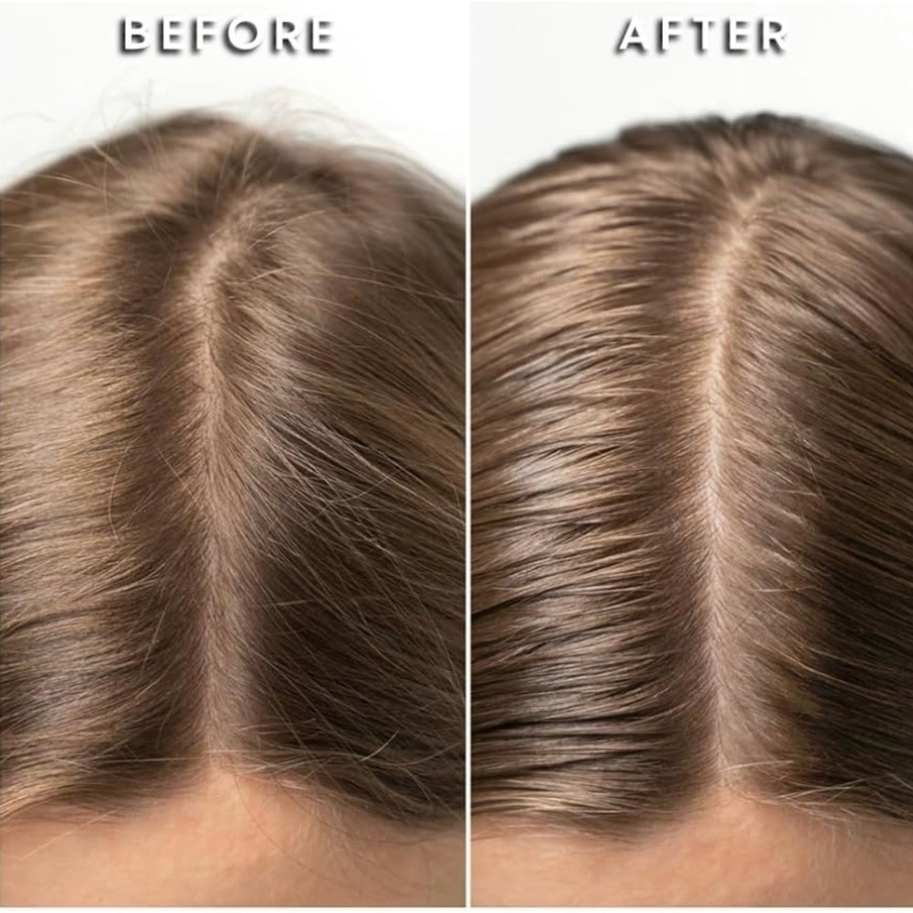 Mudmasky Vitamin-Infused Scalp Serum - Picture 6 of 9